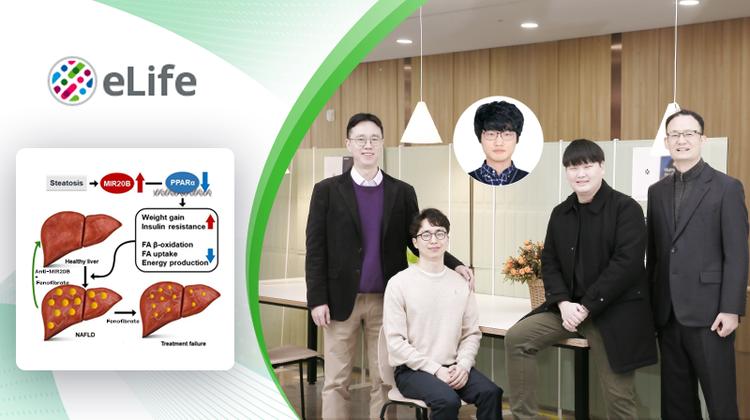 비알코올성 지방간 치료 저해 인자 규명... 치료제 개발 청신호!