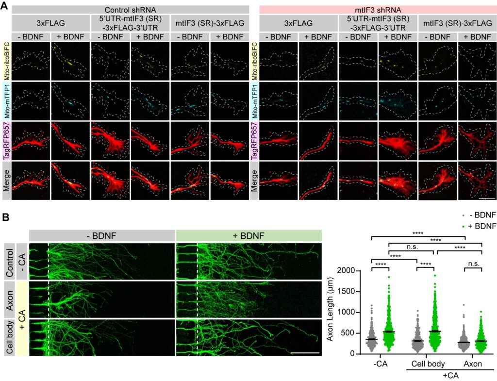 그림2. 조건을 바꿔 가며 축색돌기 말단 발달을 분석한 사진