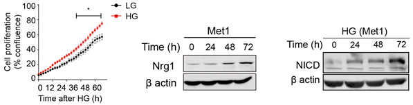 그림1. (왼쪽) 고혈당 (HG) 상태에서 유방암세포의 성장이 가속화된다