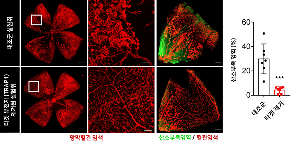 그림1. 트랩원 유전자 제거시 망막병증 개선 효과 검증