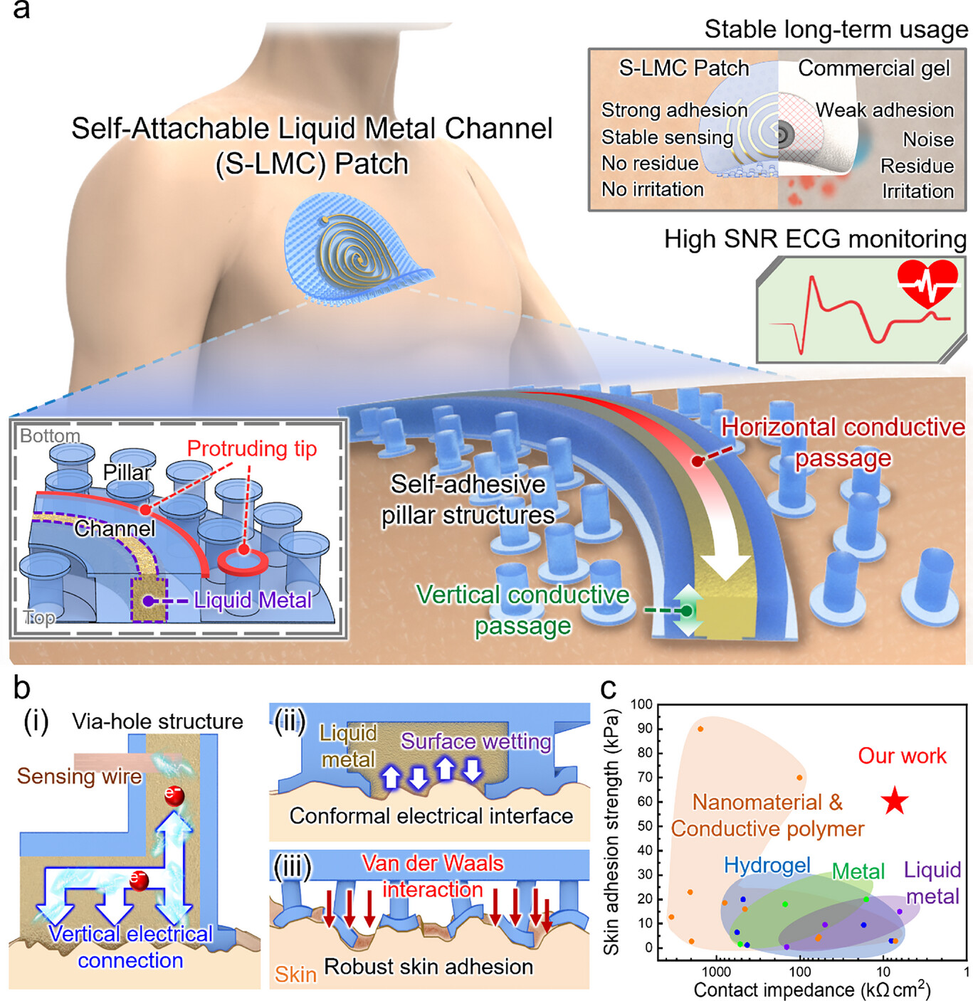 Design and key advantages of the S-LMC patch