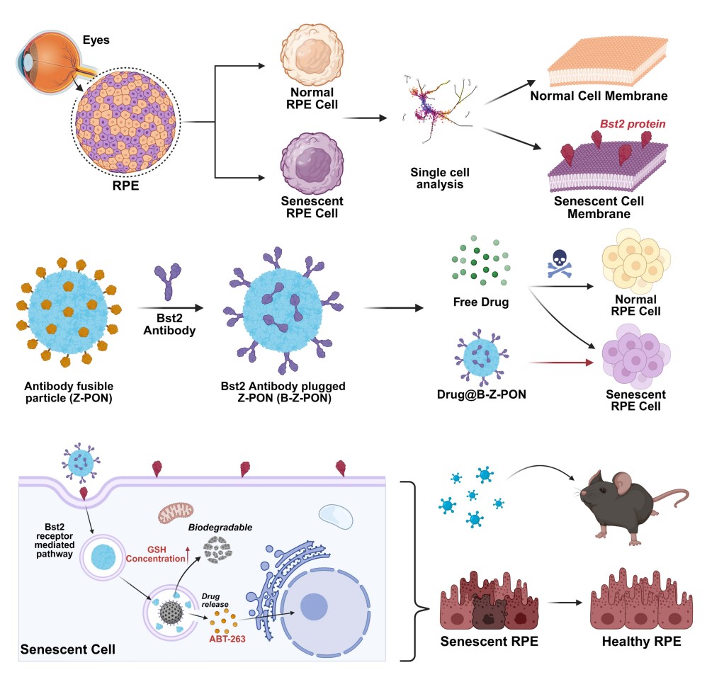 A novel nanotechnology platform that selectively removes aging retinal pigment epithelium (RPE) cells.