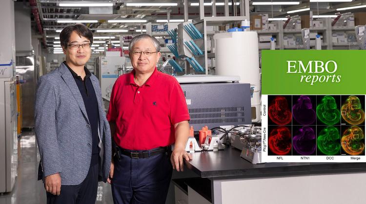 뇌 신경망 구조 만드는 분자 발견… 신경질환 원인 찾는다!